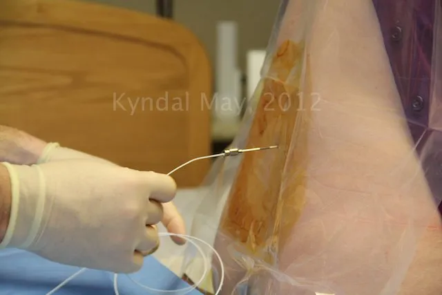 7 Fakta Penting Tentang Epidural, Bius Penahan Rasa Sakit untuk Ibu Melahirkan! 12