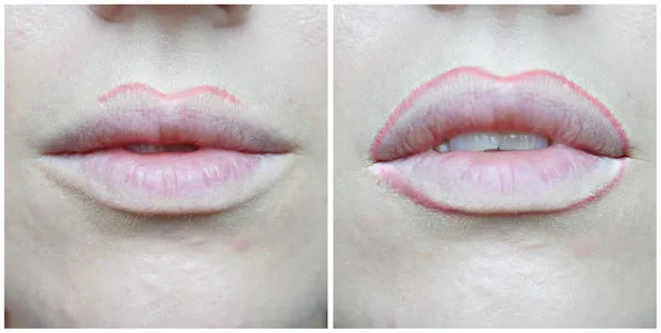 Tutorial Teknik Overdrawn Lips yang Paripurna. Dengan Begini, Bibir Tipismu Akan Merekah Merona. Mau Coba? 11