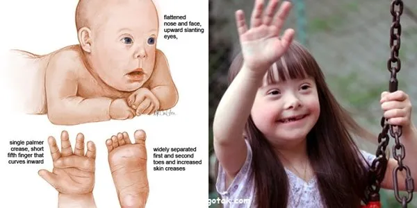 14 Fakta Down Syndrome yang Bukan Cuma Para Ibu, Tapi Semua Orang Wajib Tahu #LotsOfSocks 17
