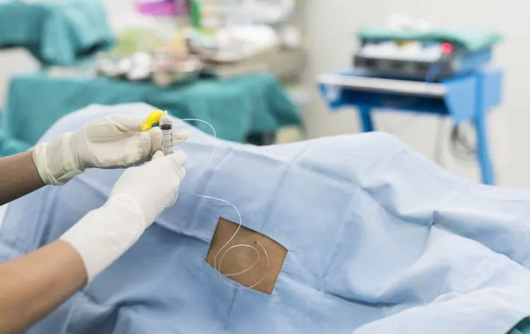 7 Fakta Penting Tentang Epidural, Bius Penahan Rasa Sakit untuk Ibu Melahirkan! 10