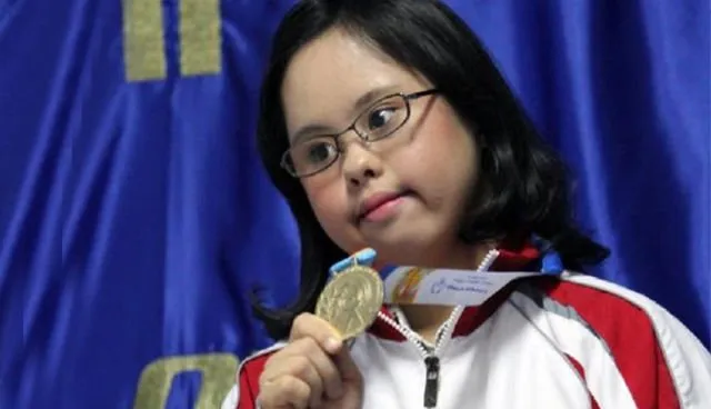 Punya Prestasi Hebat, 7 Penderita Down Syndrome Ini Buktikan Bisa Sukses Meski Sedikit Berbeda 10