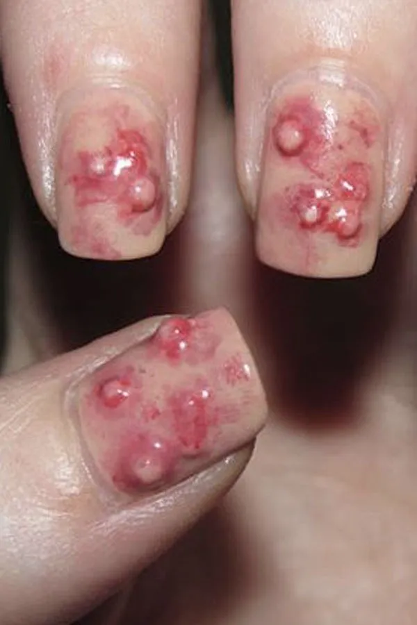 14+ Nail Art Terunik sampai Bikin Alis Kamu Mengernyit. Ada yang Lucu, Ada Pula yang Super Nyentrik 29