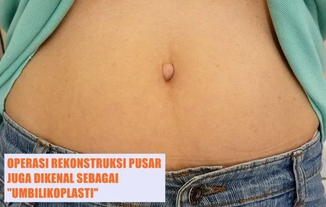10 Fakta tentang Pusar yang Perlu Kamu Tahu, ternyata Ada juga lho Jenisnya yang Favorit dan Dibenci 15