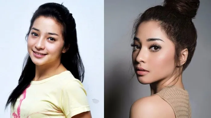 7 Usaha 'Mahal' di Balik Penampilan Sempurna Para Selebritas dan Figur Publik. Ini Lho Rahasia Para Bintang Tampil Ciamik! 12