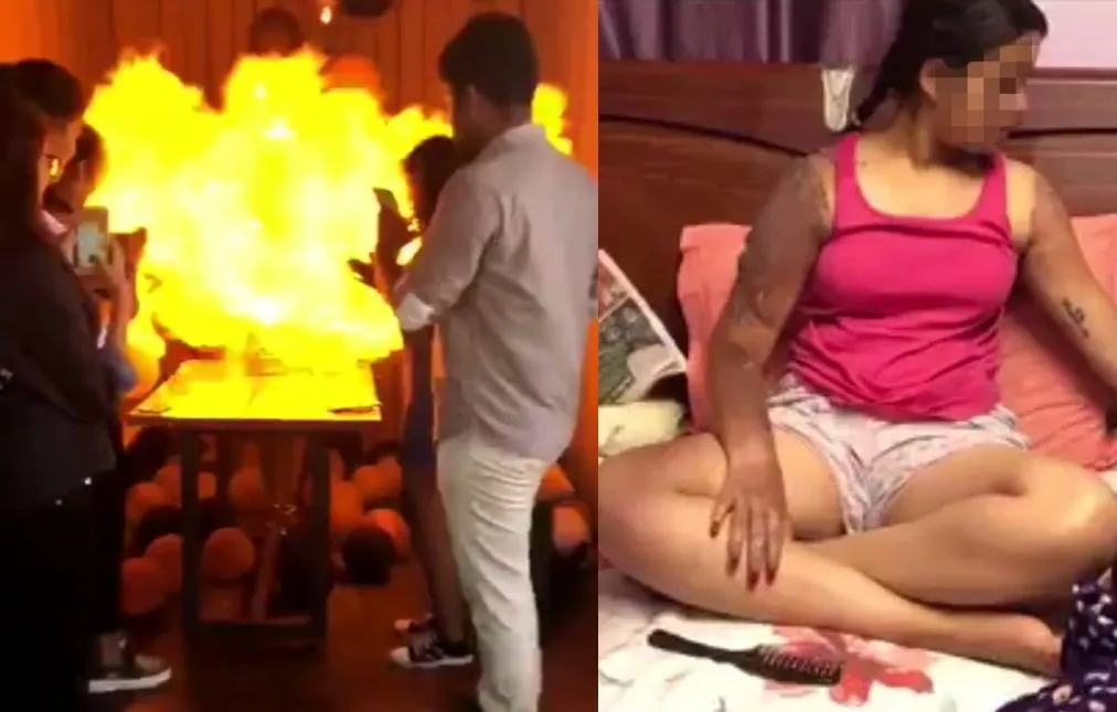 Balon Meledak Saat Nyalakan Lilin Ulang Tahun, Gadis ini Alami Luka Bakar. Hati-Hati Ya, Guys! 2