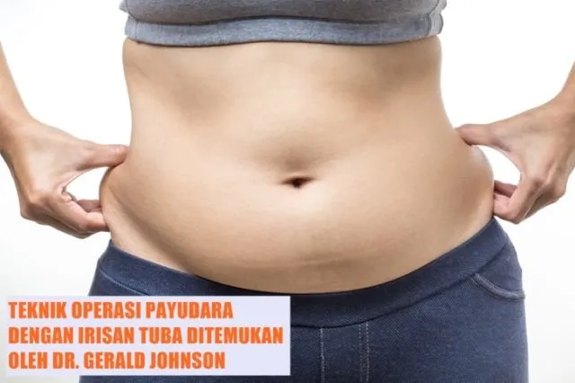 10 Fakta tentang Pusar yang Perlu Kamu Tahu, ternyata Ada juga lho Jenisnya yang Favorit dan Dibenci 17