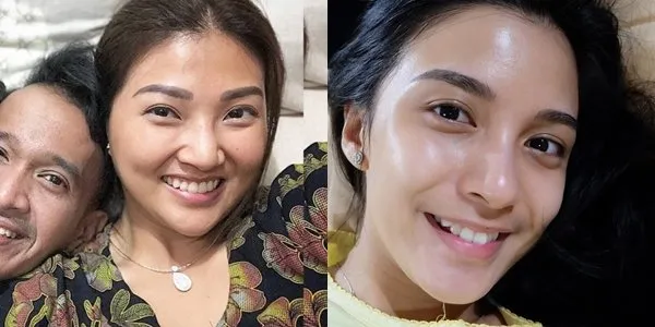 7 Usaha 'Mahal' di Balik Penampilan Sempurna Para Selebritas dan Figur Publik. Ini Lho Rahasia Para Bintang Tampil Ciamik! 9