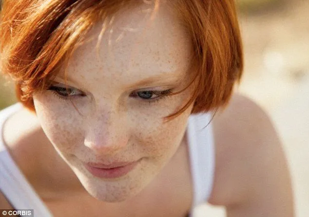 Hampir Mirip, ini lo Bedanya Freckles, Flek Hitam, dan Melasma 8 bedanya freckles dan flek hitam