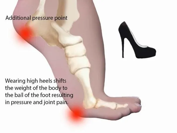 4 Alasan Kenapa Pakai Heels Itu Harusnya Selalu Jadi Pilihan, Bukan Kewajiban. Di Acara Apa pun 7