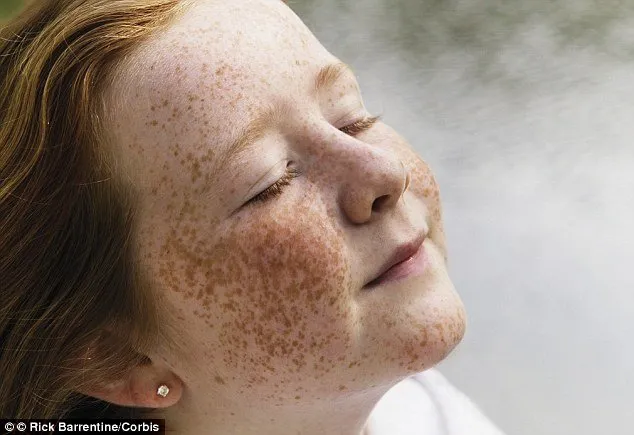 Ini Penyebab Terbentuknya Freckles di Kulit. Beda Sama Tren Make-up, Ada yang Punya Secara Alami 14