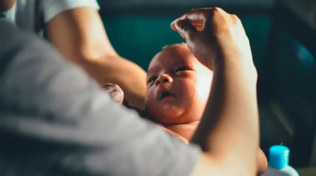 Gambaran Tali Pusar Bayi Baru Lahir yang Memikat, Usai Dipotong Pun Perlu Dirawat 28