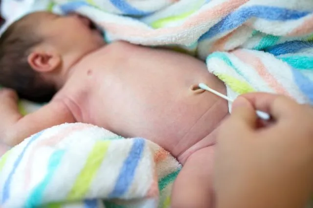 Gambaran Tali Pusar Bayi Baru Lahir yang Memikat, Usai Dipotong Pun Perlu Dirawat 32