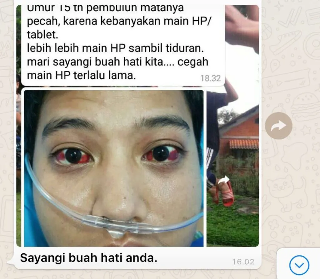 4 Kondisi yang Sebabkan Mata Merah Layaknya Berlumuran Darah. Sebenarnya Nggak Sebahaya itu Kok 7