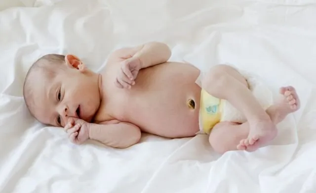 Gambaran Tali Pusar Bayi Baru Lahir yang Memikat, Usai Dipotong Pun Perlu Dirawat 31