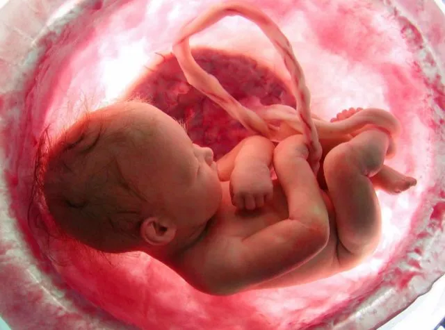 Gambaran Tali Pusar Bayi Baru Lahir yang Memikat, Usai Dipotong Pun Perlu Dirawat 17