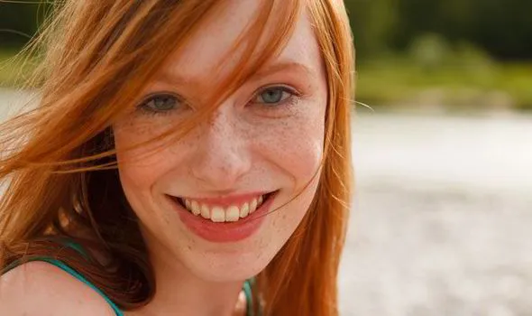 Ini Penyebab Terbentuknya Freckles di Kulit. Beda Sama Tren Make-up, Ada yang Punya Secara Alami 12