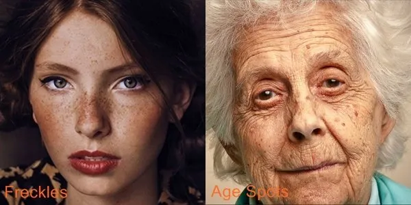 Ini Penyebab Terbentuknya Freckles di Kulit. Beda Sama Tren Make-up, Ada yang Punya Secara Alami 20