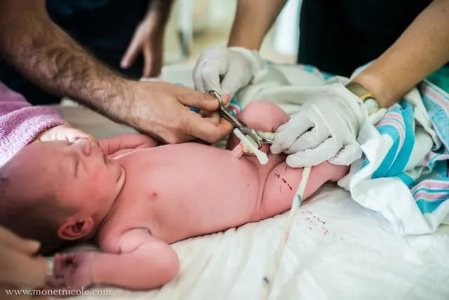 Gambaran Tali Pusar Bayi Baru Lahir yang Memikat, Usai Dipotong Pun Perlu Dirawat 23