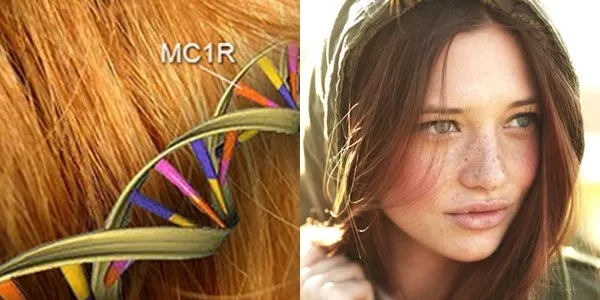 Ini Penyebab Terbentuknya Freckles di Kulit. Beda Sama Tren Make-up, Ada yang Punya Secara Alami 16