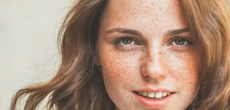 Ini Penyebab Terbentuknya Freckles di Kulit. Beda Sama Tren Make-up, Ada yang Punya Secara Alami 11