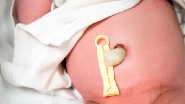 Gambaran Tali Pusar Bayi Baru Lahir yang Memikat, Usai Dipotong Pun Perlu Dirawat 30