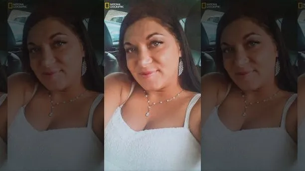 Selamat dari Percobaan Bunuh Diri, Gadis Ini Menjalani Operasi Wajah. Kisahnya Mengharukan Banget 9