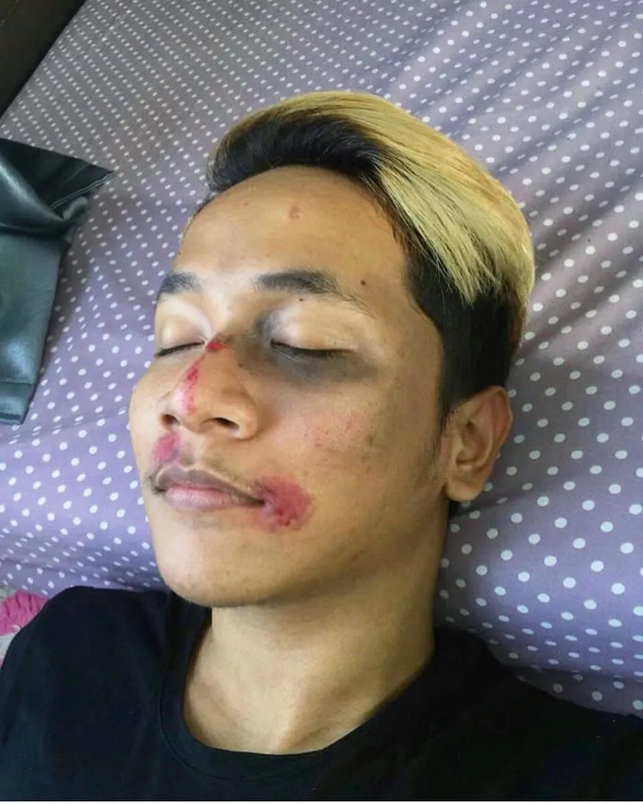 Setelah Young Lex Mengaku Dipukuli K-Popers, Kini Warganet Juga Ikutan 'Dipukuli'. Ngejek nih? 18