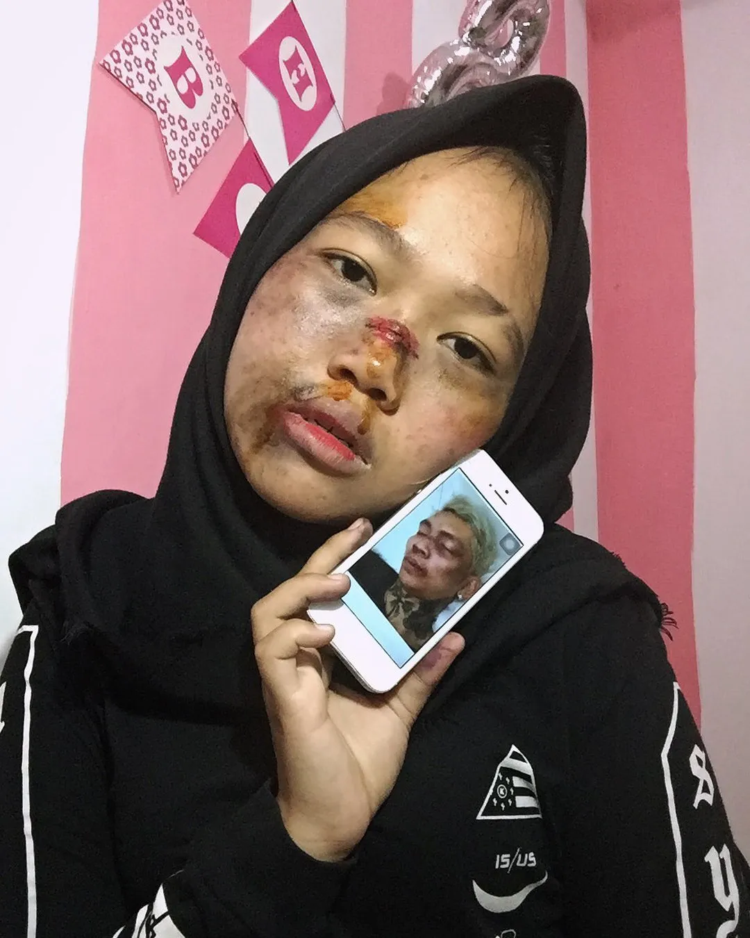 Setelah Young Lex Mengaku Dipukuli K-Popers, Kini Warganet Juga Ikutan 'Dipukuli'. Ngejek nih? 15