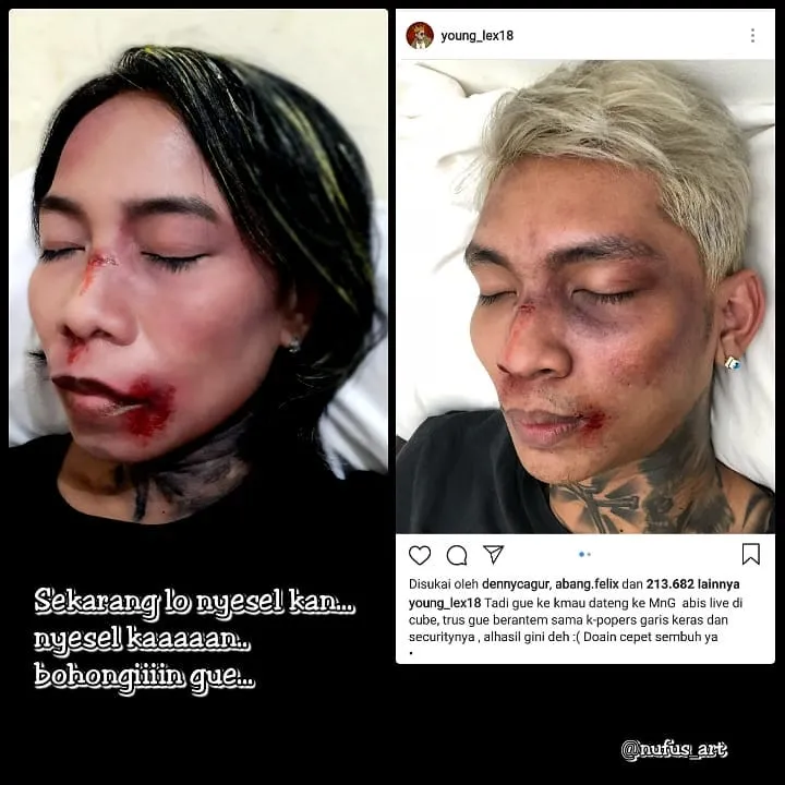 Setelah Young Lex Mengaku Dipukuli K-Popers, Kini Warganet Juga Ikutan 'Dipukuli'. Ngejek nih? 23