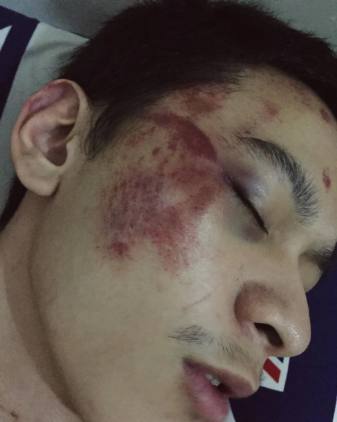 Setelah Young Lex Mengaku Dipukuli K-Popers, Kini Warganet Juga Ikutan 'Dipukuli'. Ngejek nih? 20