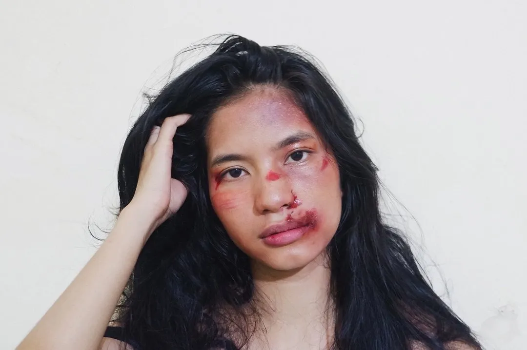 Setelah Young Lex Mengaku Dipukuli K-Popers, Kini Warganet Juga Ikutan 'Dipukuli'. Ngejek nih? 19