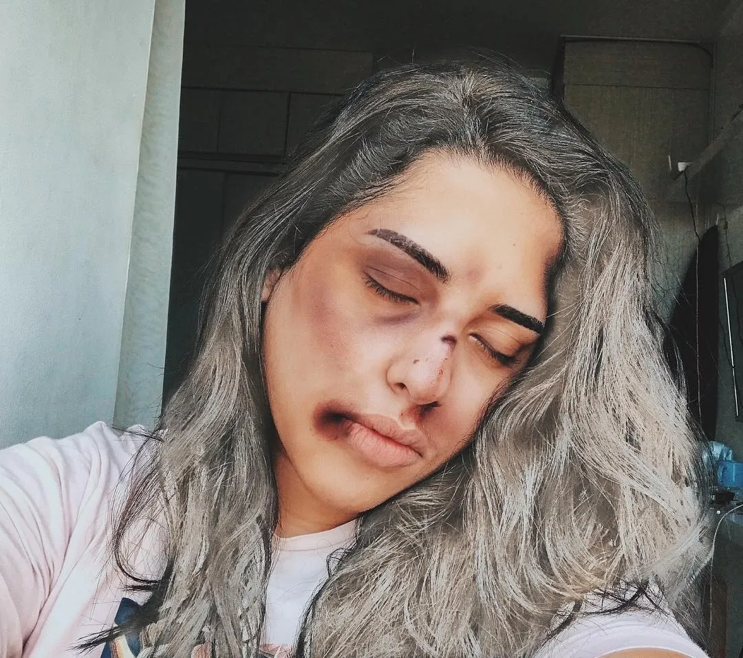 Setelah Young Lex Mengaku Dipukuli K-Popers, Kini Warganet Juga Ikutan 'Dipukuli'. Ngejek nih? 14