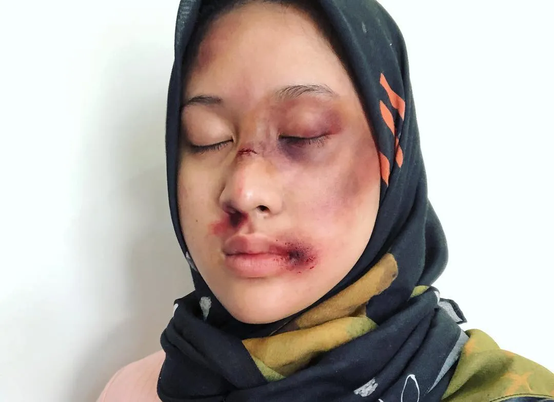 Setelah Young Lex Mengaku Dipukuli K-Popers, Kini Warganet Juga Ikutan 'Dipukuli'. Ngejek nih? 16