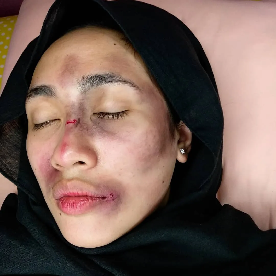 Setelah Young Lex Mengaku Dipukuli K-Popers, Kini Warganet Juga Ikutan 'Dipukuli'. Ngejek nih? 21