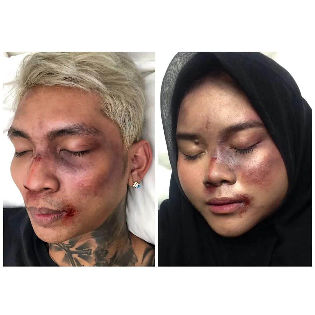 Setelah Young Lex Mengaku Dipukuli K-Popers, Kini Warganet Juga Ikutan 'Dipukuli'. Ngejek nih? 25