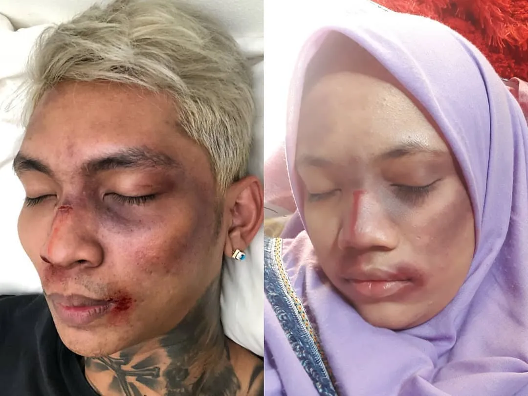 Setelah Young Lex Mengaku Dipukuli K-Popers, Kini Warganet Juga Ikutan 'Dipukuli'. Ngejek nih? 22