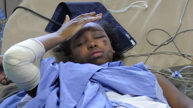 Anak 12 Tahun Ini Jadi ‘Sole Survivor’, Satu-Satunya yang Selamat dalam Kecelakaan Pesawat di Papua 6