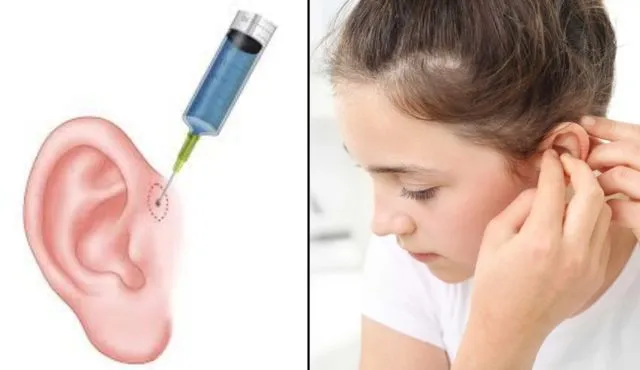 Tentang Infeksi Sinus Preauricular yang Diderita Anak Anji, dan Hubungannya dengan Lubang Telinga Mini 8