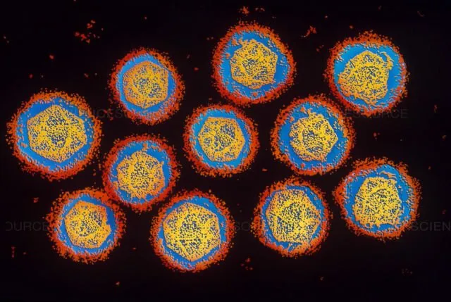 Sekilas Mirip Lukisan, 12 Gambar Ini Adalah Penampakan Virus dan Bakteri yang Diperbesar 16