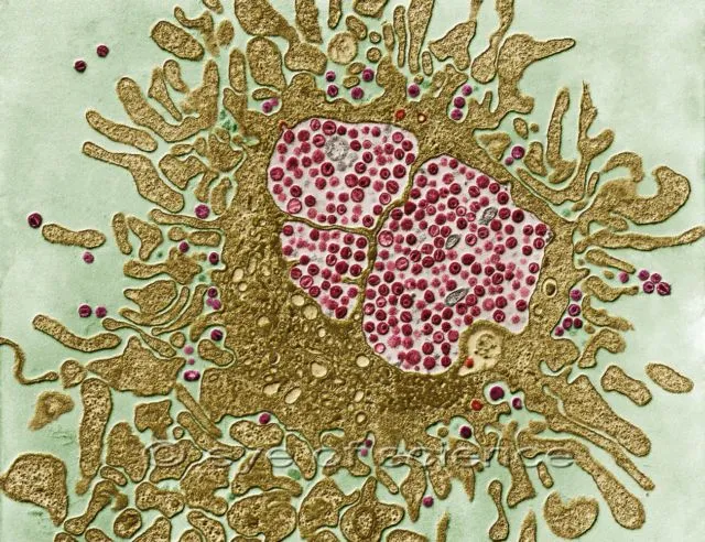 Sekilas Mirip Lukisan, 12 Gambar Ini Adalah Penampakan Virus dan Bakteri yang Diperbesar 23