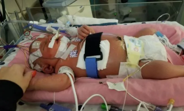 Stop Sembarangan Pegang & Cium Bayi Baru Lahir, Kalau Tidak Mau Kulitnya Jadi Melepuh Kayak Gini 6