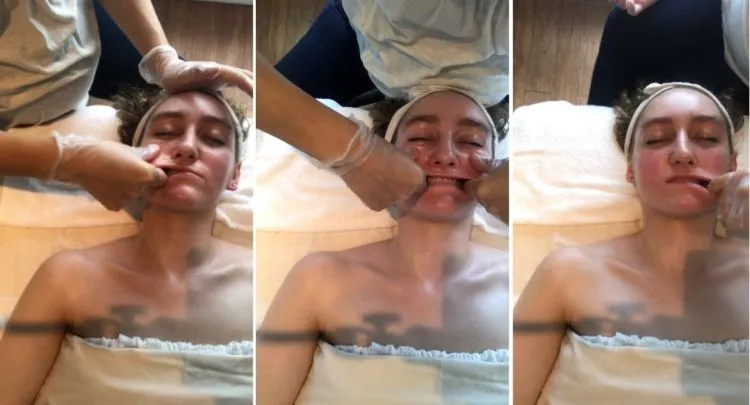8 Fakta Seputar Facial Buccal, Perawatan 'Obok-obok Mulut' Favoritnya Meghan Markle. Katanya Sih Bikin Glowing Instant 11