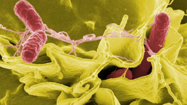Sekilas Mirip Lukisan, 12 Gambar Ini Adalah Penampakan Virus dan Bakteri yang Diperbesar 14