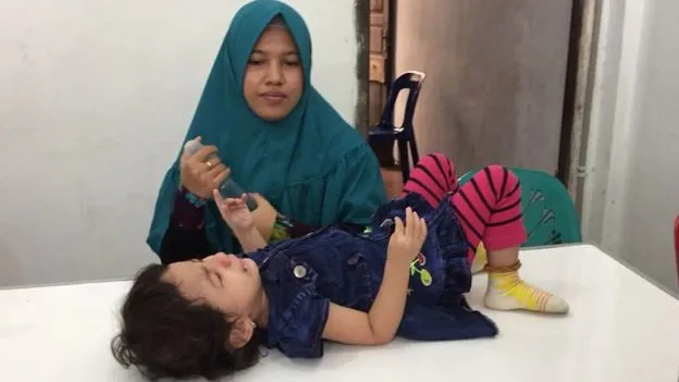 Penyakit Rubella Ancam Aceh Gara-Gara Plt Gubernur Tunda Vaksinasinya. Kesehatan Anak Jadi Taruhan 8