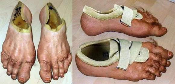 Lupakan Sneakers Mahal nan Gaul itu. Kalau Pakai Sepatu Super Nyeleneh ini, Kamu Berani Nggak? 22