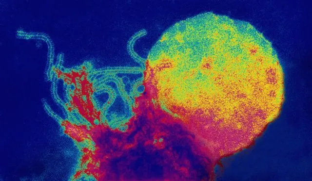 Sekilas Mirip Lukisan, 12 Gambar Ini Adalah Penampakan Virus dan Bakteri yang Diperbesar 18