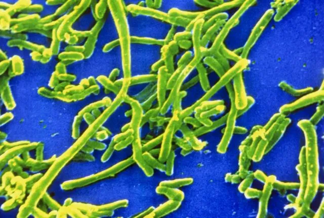 Sekilas Mirip Lukisan, 12 Gambar Ini Adalah Penampakan Virus dan Bakteri yang Diperbesar 21