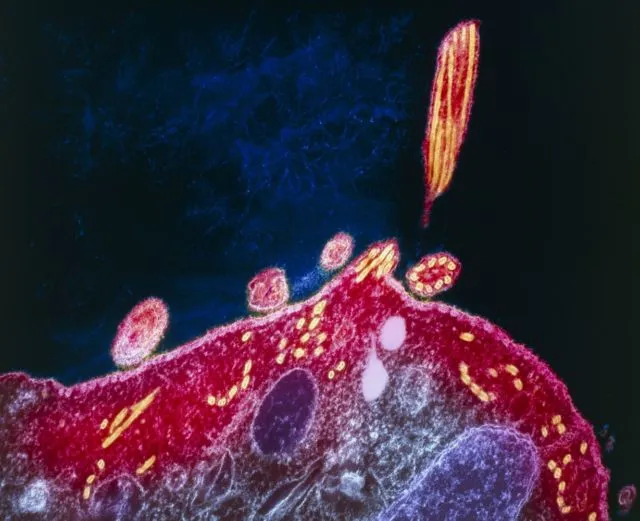 Sekilas Mirip Lukisan, 12 Gambar Ini Adalah Penampakan Virus dan Bakteri yang Diperbesar 22