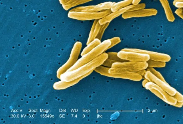 Sekilas Mirip Lukisan, 12 Gambar Ini Adalah Penampakan Virus dan Bakteri yang Diperbesar 19