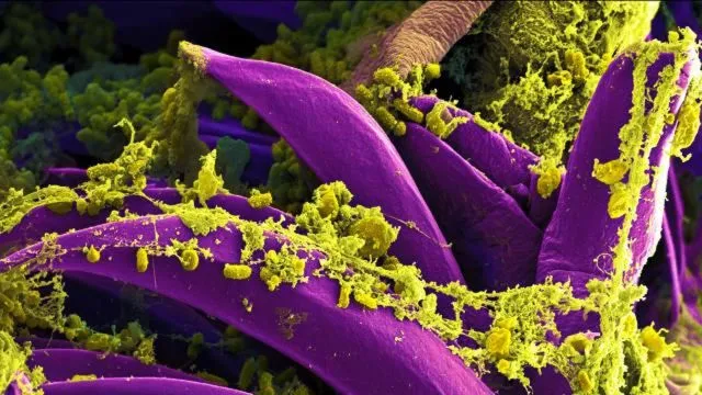 Sekilas Mirip Lukisan, 12 Gambar Ini Adalah Penampakan Virus dan Bakteri yang Diperbesar 24